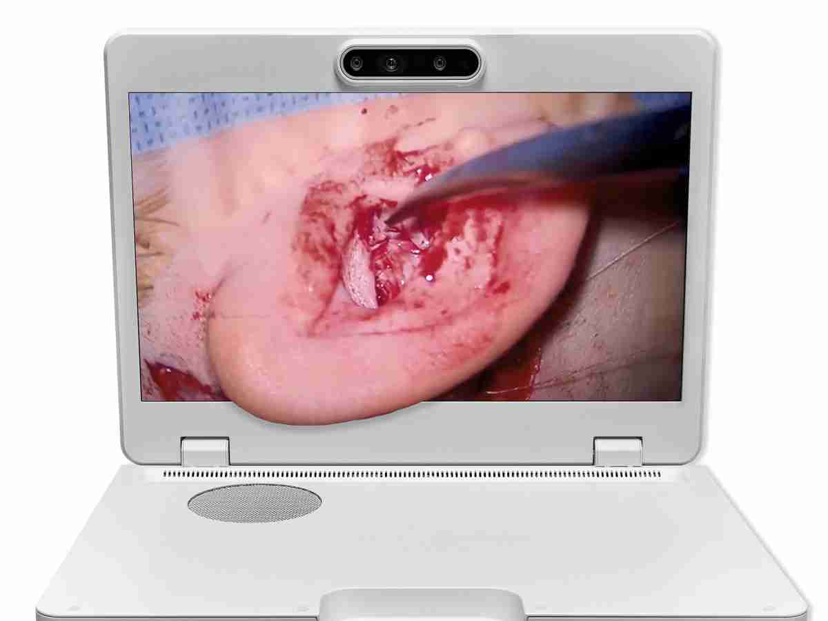 达擎之＂Heads-up 3D显微手术显示系统＂，，，，整合4K裸眼3D显示及眼球追踪系统，，，具备快速追踪人眼移动位置功能，，，减轻医师长时间维持固定姿势的负担，，，，让医师能有更宽广清晰的3D立体视野及更舒适的姿势来执行手术。。